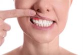 Foto: Diabetes en España: Más del 50% pierde algún diente y el 66% sufre periodontitis