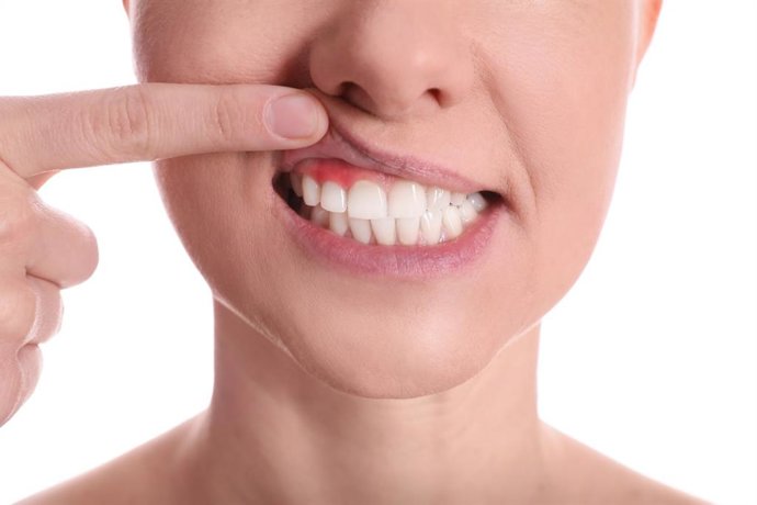 Archivo - Dientes.