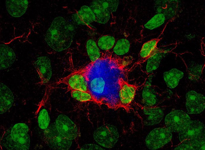 La microglia (en roig) respon al tractament encapsulant i reduint la grandària de les plaques amiloideas (en blava) i protegint les neurones. Els nuclis cel·lulars es mostren en verd. /