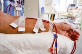 Foto: Hematólogos alertan sobre el uso de la aféresis con fines antienvejecimiento en personas sanas