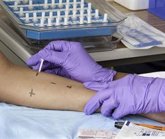 Foto: La SEAIC reclama reconocer la atención alergológica como una "parte esencial" del sistema sanitario