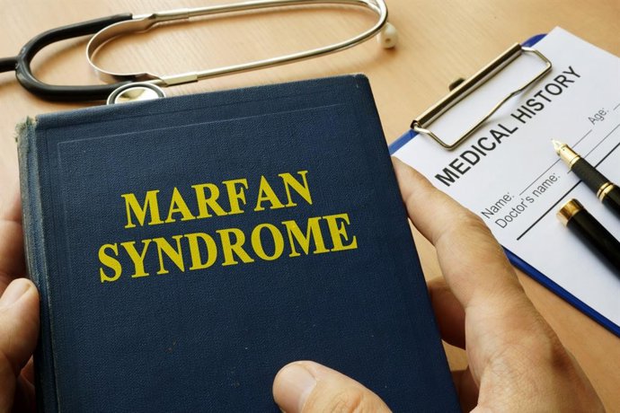 Archivo - Síndrome de Marfan