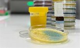 Foto: El Hospital Sant Joan de Déu de Barcelona crea una vacuna personalizada contra infecciones de orina recurrentes