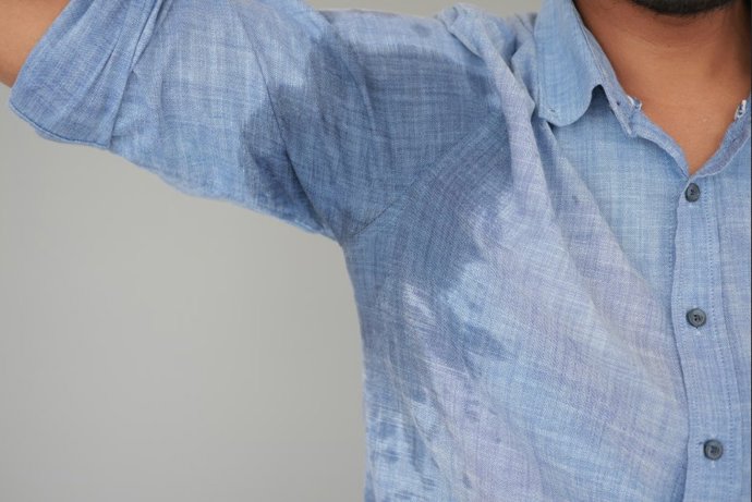 Experta destaca los tratamientos avanzados en hiperhidrosis axilar, que puede reducirse hasta en un 70%