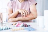 Foto: ¿Puede aparecer una alergia a un medicamento después de años tomándolo? Atención a estos fármacos