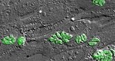 Foto: Piden a la OMS reconocer la toxoplasmosis ocular como enfermedad tropical desatendida: afecta a 1 de cada 3 personas