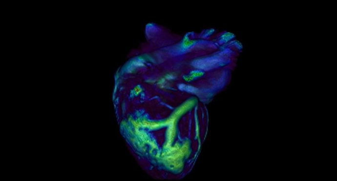 Corazón con arterias dañadas (en verde) en un modelo de la enfermedad rara infantil de Kawasaki, que inflama los vasos sanguíneos.