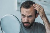 Foto: Especialista destaca el cambio de paradigma en el abordaje de la alopecia, con diferentes estrategias según el paciente