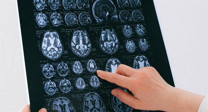 Imagen Cerebral
