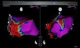 Foto: El Gregorio Marañón colidera un macroproyecto europeo que busca proteger el corazón en pacientes con cáncer