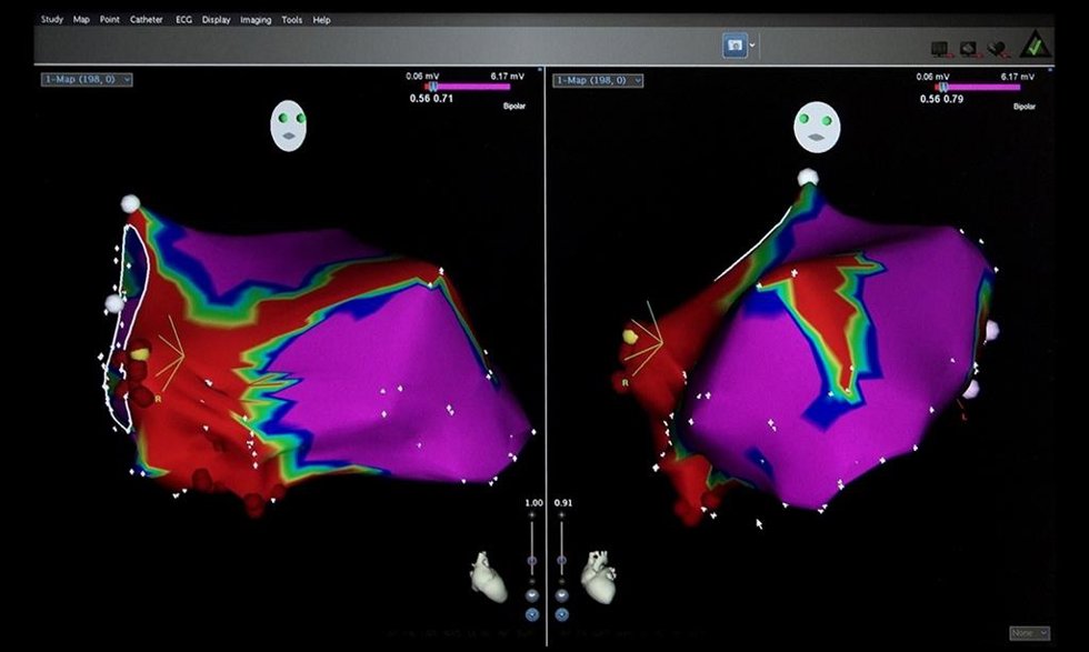 El Hospital Gregorio Marañón colidera ‘COMPASS’, un macroproyecto europeo para proteger el corazón de los pacientes con cáncer