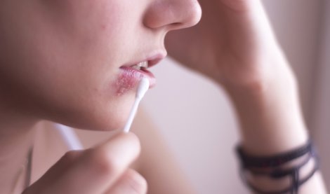 Estética