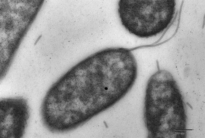 Vibrio vulnificus