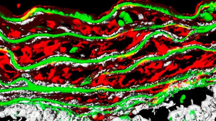 Detalhe da parede da aorta em um modelo experimental da síndrome de Marfan.