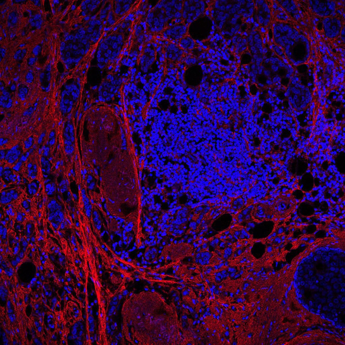 Un estudio coliderado por el IBBTEC identifica un mecanismo molecular natural que frena la progresión tumoral