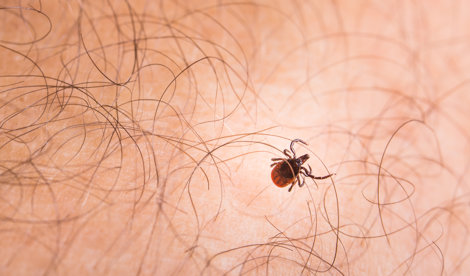 Investigación
