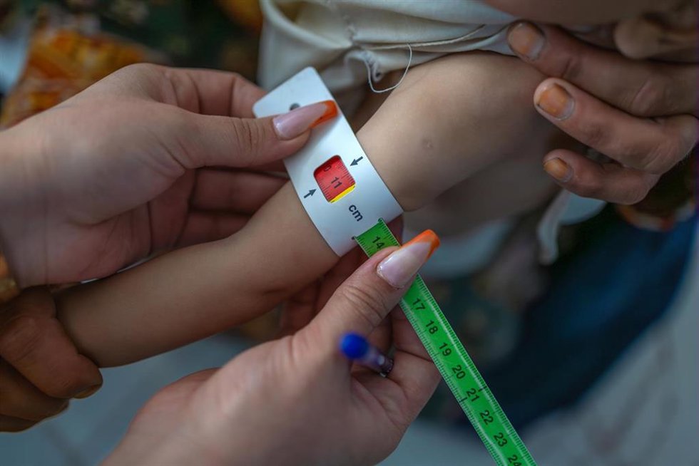 Análisis de circunferencia de brazo a un bebé de diez meses para analizar su estatus nutricional en Afganistán