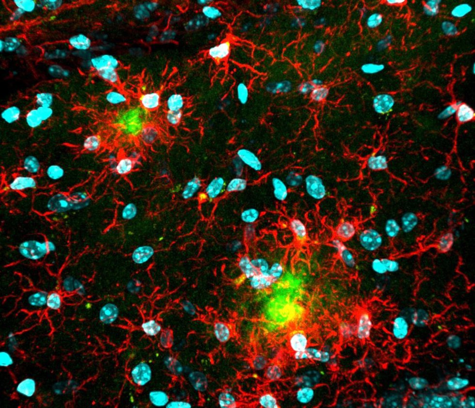 Imagen del cerebro de un ratón modelo de enfermedad de Alzheimer. Las células de la microglía (rojo) rodean placas amiloides (verde).