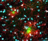 Foto: Identifican una vía inmunitaria que podría contribuir a la mayor vulnerabilidad de las mujeres frente al Alzheimer