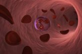 Foto: Una terapia experimental muestra resultados prometedores contra una de las leucemias más difíciles de tratar