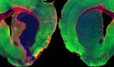 Foto: Un estudio liderado por el CSIC revela que una molécula del organismo reduce inflamación y daño cerebral tras ictus