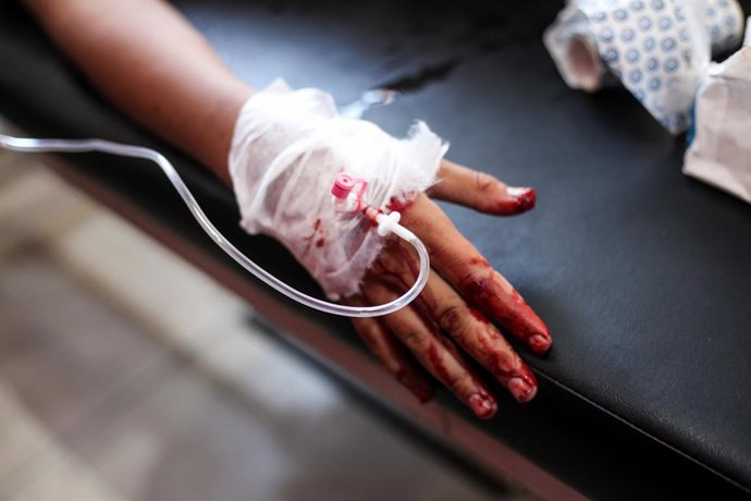 July 17, 2026, Nusairat, Gaza Strip, Palestinian Territory: A wounded Palestinian child receives treatment at Al-Awda Hospital in the Nuseirat refugee camp, central Gaza Strip. According to the information provided, an Israeli army strike targeted a gathe