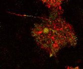 Foto: Un estudio internacional con intervención del CSIC halla células cerebrales patológicas hasta ahora consideradas inocuas