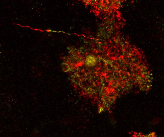 Un estudio internacional con intervención del CSIC halla células cerebrales patológicas hasta ahora consideradas inocuas