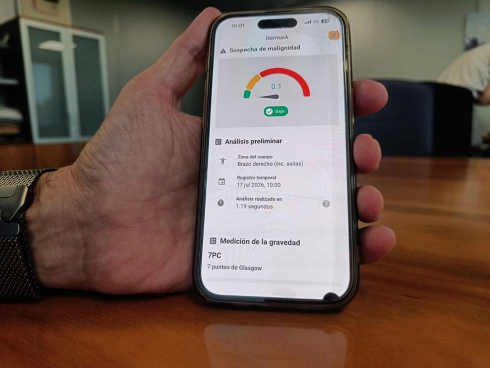 Un diagnóstico realizado a través de la nueva herramienta de inteligencia artificial para el análisis de lesiones dermatológicas, con el nivel de sospecha de malignidad.