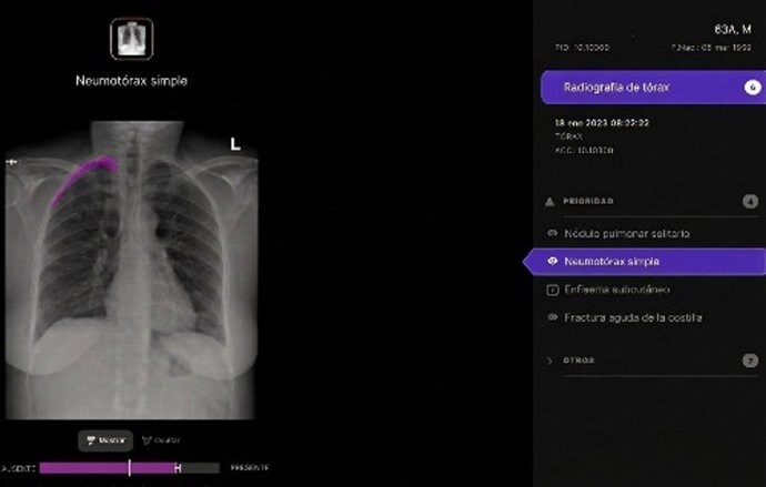 Radiografía