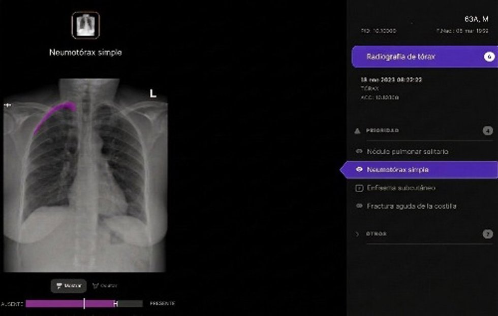 Radiografía