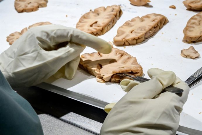 Uma análise de sangue permite estimar o risco de Alzheimer em pessoas saudáveis até uma década antes, segundo um estudo