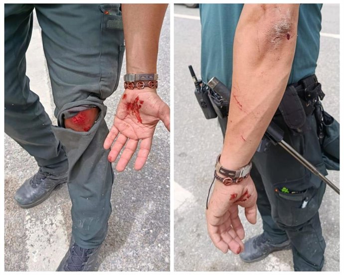 Heridas sufridas por un agente de la Guardia Civil en la frontera de Ceuta durante un intento de entrada irregular
