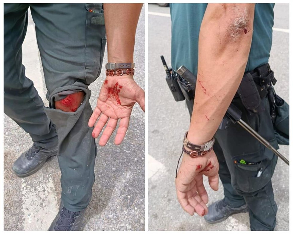 Heridas sufridas por un agente de la Guardia Civil en la frontera de Ceuta durante un intento de entrada irregular