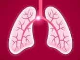 Foto: Un lenguaje único para salvar vidas: 7 sociedades médicas crean el estándar unificado para evaluar la embolia pulmonar