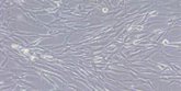 Foto: Hallan un escudo del cáncer de vías biliares intrahepático para resistir a quimioterapia