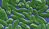 Foto: Investigadora asegura que el riesgo de infección grave por la 'bacteria carnívora' es "bajo" en población general