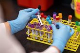 Foto: Empresas.- Siemens Healthineers lanza el análisis de muestras de sangre capilar en 'Atellica Solution' y 'Atellica CI'