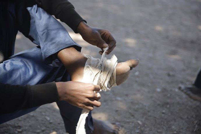 Una persona se venda un pie, a 2 de agosto de 2026, en Ceuta (España). La frontera del Tarajal ha permanecido tranquila a pesar de que un pequeño grupo de personas ha intentado acceder a nado, pero han sido interceptadas por el Ejército. Aunque ya han sal