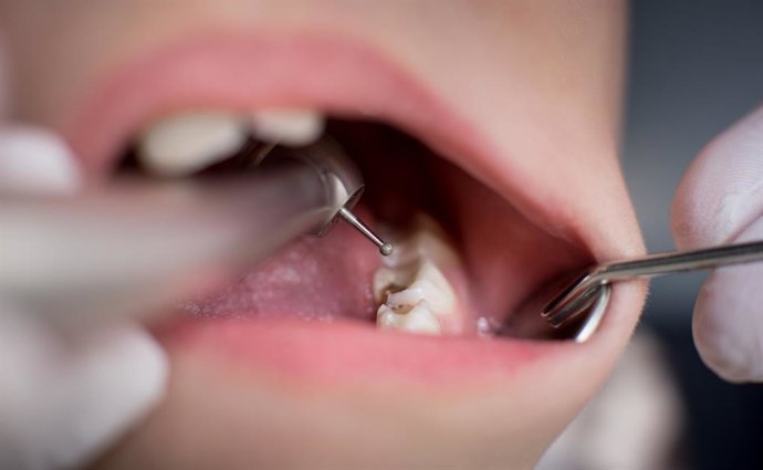 Archivo - Arquivo - Cárie infantil, dentista, criança, dentes