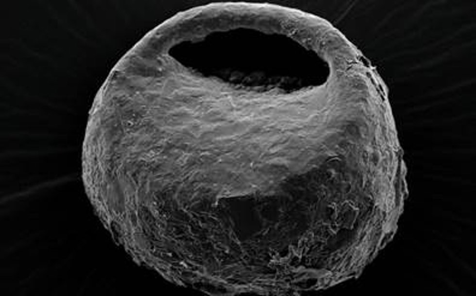 Imagen de microscopía electrónica de la especie terrestre Centropyxis orbicularis.