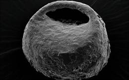 Imagem de microscopia eletrônica da espécie terrestre Centropyxis orbicularis.