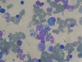 Foto: La OMS actualiza las directrices contra la leishmaniasis con tratamientos más cortos y seguros para el kala-azar
