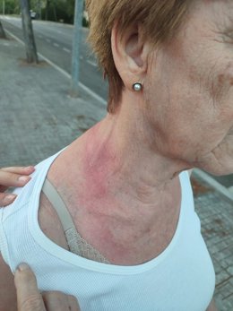 Una de las víctimas, con lesiones provocadas a raíz del robo