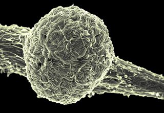 (Foto de ARCHIVO)  La variante Makona del virus del ébola cubre la superficie de una célula infectada.    REMITIDA / HANDOUT por NIAID  21/10/2019