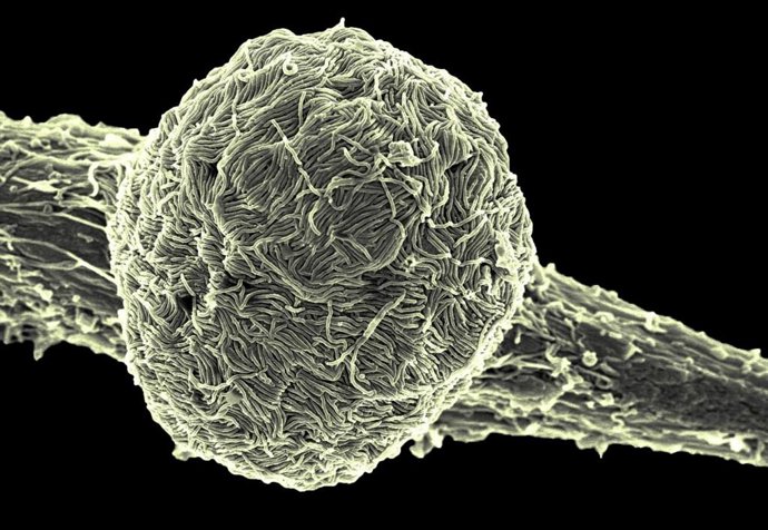 (Foto de ARCHIVO)  La variante Makona del virus del ébola cubre la superficie de una célula infectada.    REMITIDA / HANDOUT por NIAID  21/10/2019