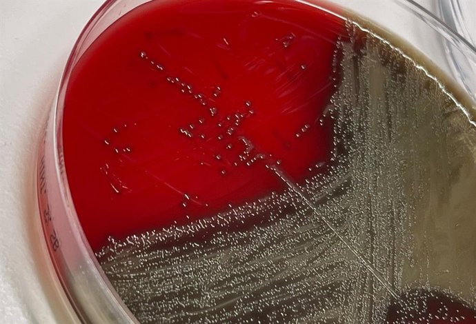 Imagen de un cultivo en laboratorio de 'Streptococcus pneumoniae'.