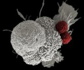 Foto: Un proyecto internacional genera modelos de 25 tipos de cáncer derivados de pacientes
