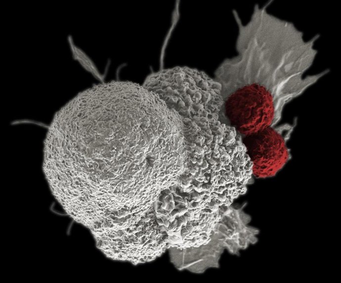 Modelo de tumor.