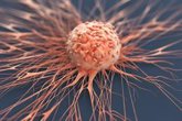 Foto: Descubren una nueva vía para atacar el cáncer a través de la proteína c-Myc y SLK